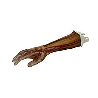 True Phantom Solutions AR-A02 Adult Arm (Complex) For X-Ray CT, US, MRI