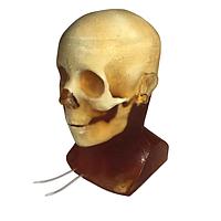 True Phantom Solutions HD-A05 Adult Head (Hematoma) For X-Ray CT, US, MRI
