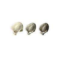 True Phantom Solutions TW-C01 Temporal Bone Phantoms For X-Ray CT, US, MRI